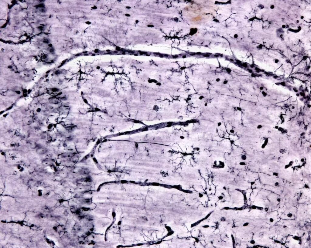 Das muitas células cerebrais (mostradas em preto), dar um impulso à micróglia poderia ajudá-las a limpar de forma mais eficaz os detritos no cérebro. Fonte: Jose Luis Calvo Martin e Jose Enrique Garcia-Mauriño Muzquiz/iStock via Getty Images Plus.